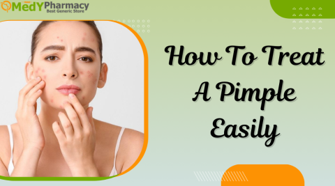 How to Treat a Pimple Easily