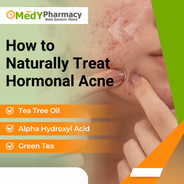 How to Naturally Treat Hormonal Acne.