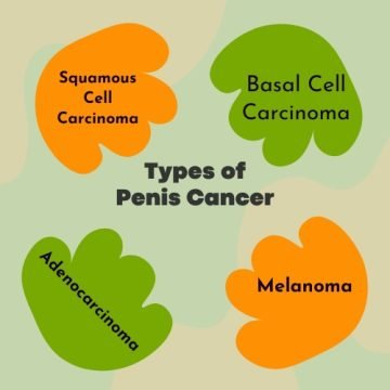 Types of Penis Cancer
