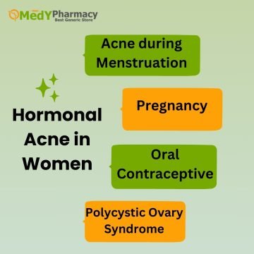 Hormonal Acne in Women