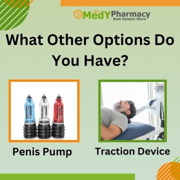 What Other Options Do You Have?