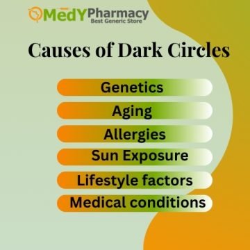 Causes of Dark Circles
