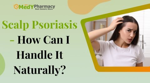 Scalp Psoriasis - How Can I Handle It Naturally?