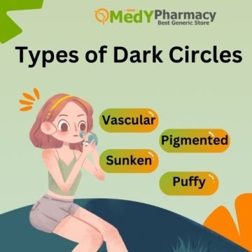 Types of Dark Circles