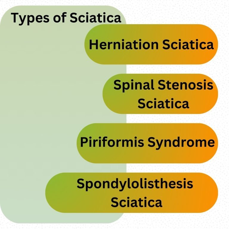 Types of Sciatica