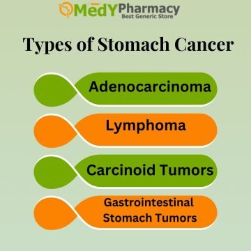 Types of Stomach Cancer