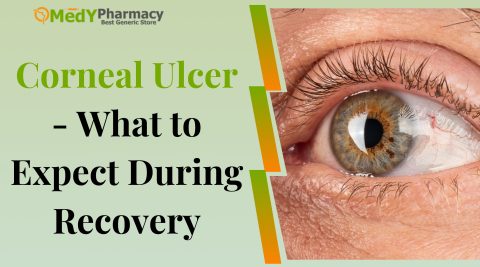 Corneal Ulcer - What to Expect During Recovery