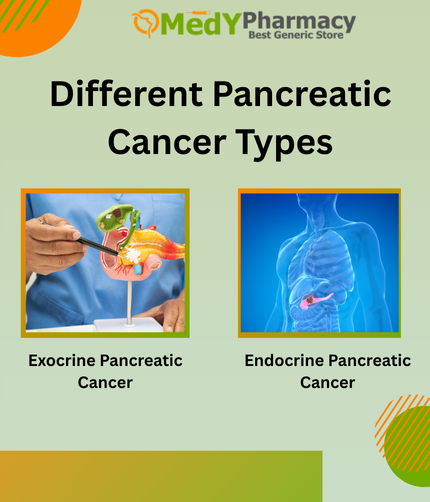 Different Pancreatic Cancer Types