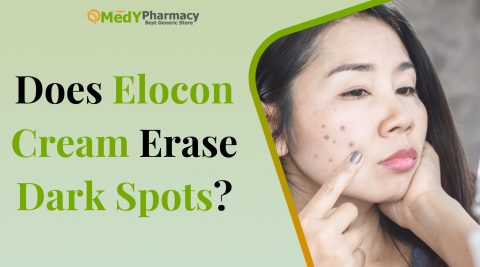 Does Elocon Cream Erase Dark Spots?
