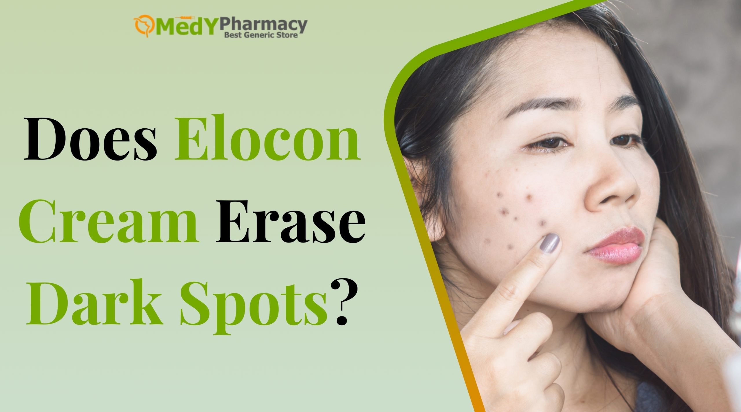 Does Elocon Cream Erase Dark Spots?