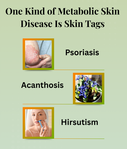One Kind of Metabolic Skin Disease Is Skin Tags